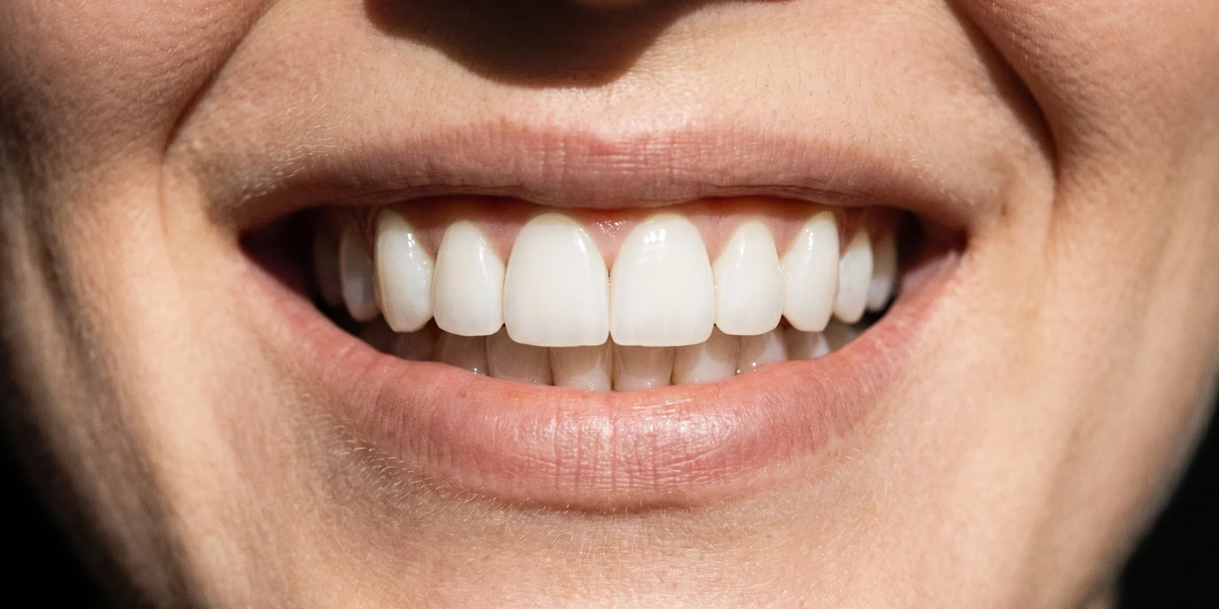Illustration: smile after treatment